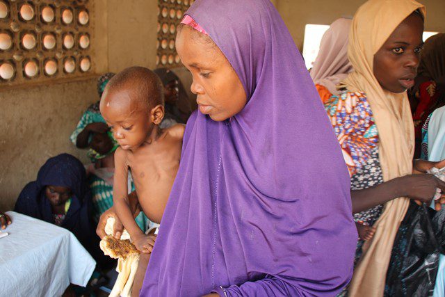 Child malnutrition mounts amid conflict in northeast Nigeria