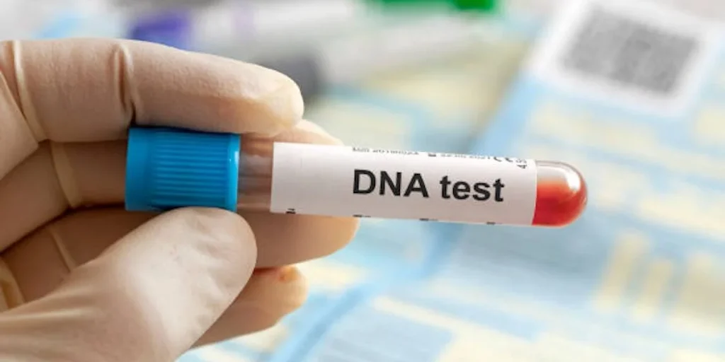DNA-test